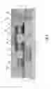 Fig. 06 - BEOL compatible FET structure