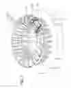 Fig. 07 - Protector mounting apparatus for protector mounted on the windings of a motor