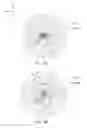 Fig. 09 - Chip antenna mounting apparatus