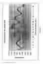 Fig. 04 - ADVANCED CORNEAL TOPOGRAPHY SYSTEM