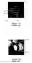 Fig. 02 - Method of eye examination by optical coherence tomography