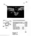 Fig. 04 - Method of eye examination by optical coherence tomography