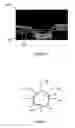 Fig. 07 - Method of eye examination by optical coherence tomography