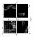 Fig. 09 - Method of eye examination by optical coherence tomography