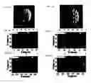 Fig. 04 - Systems and methods for detecting radiation, biotoxin, chemical, and biological warfare agents using a multiple angle light scattering (MALS) instrument