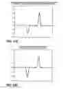 Fig. 12 - System and method for coherent optical inspection