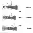 Fig. 05 - Hydraulic optical focusing-stabilizer
