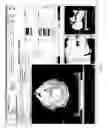 Fig. 08 - System and method of generating contour structures using a dose volume histogram