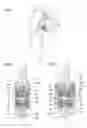 Fig. 02 - Device for connecting bony portions