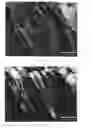 Fig. 06 - Method of treating periodontitis and of reducing dentinal sensitivity