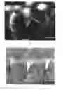Fig. 08 - Method of treating periodontitis and of reducing dentinal sensitivity