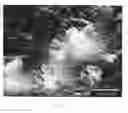 Fig. 09 - Method of treating periodontitis and of reducing dentinal sensitivity