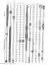 Fig. 02 - RECOMBINANT PERFORIN, EXPRESSION AND USES THEREOF