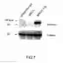 Fig. 09 - RECOMBINANT PERFORIN, EXPRESSION AND USES THEREOF