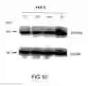 Fig. 12 - RECOMBINANT PERFORIN, EXPRESSION AND USES THEREOF