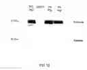 Fig. 17 - RECOMBINANT PERFORIN, EXPRESSION AND USES THEREOF