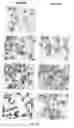 Fig. 23 - RECOMBINANT PERFORIN, EXPRESSION AND USES THEREOF