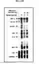 Fig. 14 - Methods of treating or preventing inflammation and hypersensitivity with oxidative reductive potential water solution