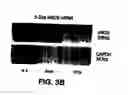 Fig. 06 - Medical device with coating that promotes endothelial cell adherence and differentiation