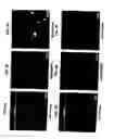 Fig. 08 - Medical device with coating that promotes endothelial cell adherence and differentiation