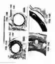Fig. 18 - Medical device with coating that promotes endothelial cell adherence and differentiation