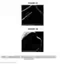 Fig. 17 - Implantable medical device coatings with biodegradable elastomer and releasable therapeutic agent