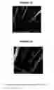 Fig. 18 - Implantable medical device coatings with biodegradable elastomer and releasable therapeutic agent