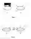 Fig. 02 - Synthetic muscle-based multi-powered active contact lens