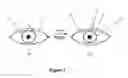 Fig. 04 - Synthetic muscle-based multi-powered active contact lens