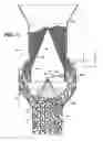 Fig. 06 - Apparatus for treating particles utilizing a flow control device