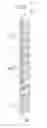 Fig. 08 - Laminated core for electromagnetic applications