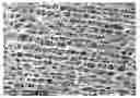 Fig. 01 - Biaxially oriented microporous membrane