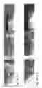 Fig. 04 - Cemented carbide and method of making the same