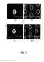 Fig. 03 - METHOD FOR FORMING FINE PATTERN OF SEMICONDUCTOR DEVICE