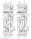 Fig. 03 - Chronic obstructive pulmonary disease simulator