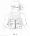 Fig. 04 - Chronic obstructive pulmonary disease simulator