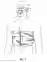 Fig. 05 - Chronic obstructive pulmonary disease simulator