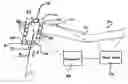 Fig. 01 - Instrument with pressure sensing capabilities