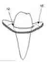 Fig. 01 - Dental appliance for deflecting gingival tissue