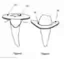 Fig. 06 - Dental appliance for deflecting gingival tissue