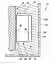 Fig. 01 - Orthodontic treatment methods, systems and apparatus for use therewith