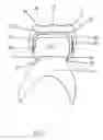 Fig. 02 - Prefabricated Dental Crowns