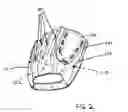 Fig. 03 - Motivational baseball glove