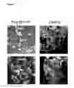Fig. 08 - Polymerized Hemoglobin Media and its Use in Isolation and Transplantation of Islet Cells
