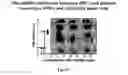 Fig. 99 - Devices and methods for enrichment and alteration of cells and other particles