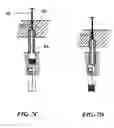 Fig. 06 - Open channel solid phase extraction systems and methods