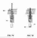 Fig. 08 - Open channel solid phase extraction systems and methods