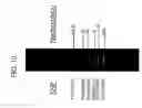Fig. 23 - Rapid analysis of variations in a genome