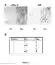 Fig. 07 - DETECTION OF PHOSPHORYLATED eIF2-alpha AS A DIAGNOSTIC TEST FOR EFFICACY AND SENSITIVITY OF TRANSLATION INITIATION INHIBITORS IN THE TREATMENT OF CANCER AND OTHER PROLIFERATIVE DISEASES