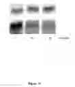 Fig. 12 - DETECTION OF PHOSPHORYLATED eIF2-alpha AS A DIAGNOSTIC TEST FOR EFFICACY AND SENSITIVITY OF TRANSLATION INITIATION INHIBITORS IN THE TREATMENT OF CANCER AND OTHER PROLIFERATIVE DISEASES
